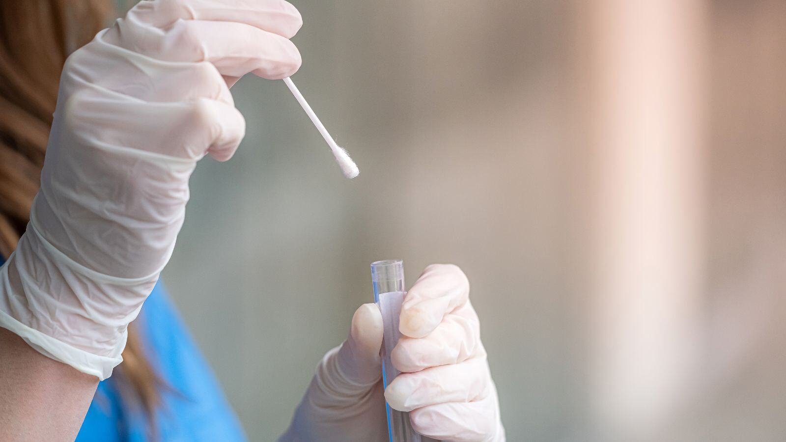 In Vitro Diagnostics