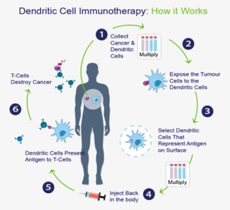 Dendritic Cell Immunotherapy - QbD
